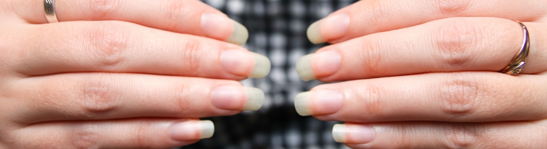 co oznaczają białe plamy na paznokciach